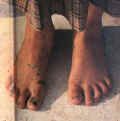 Healthy Amish feet